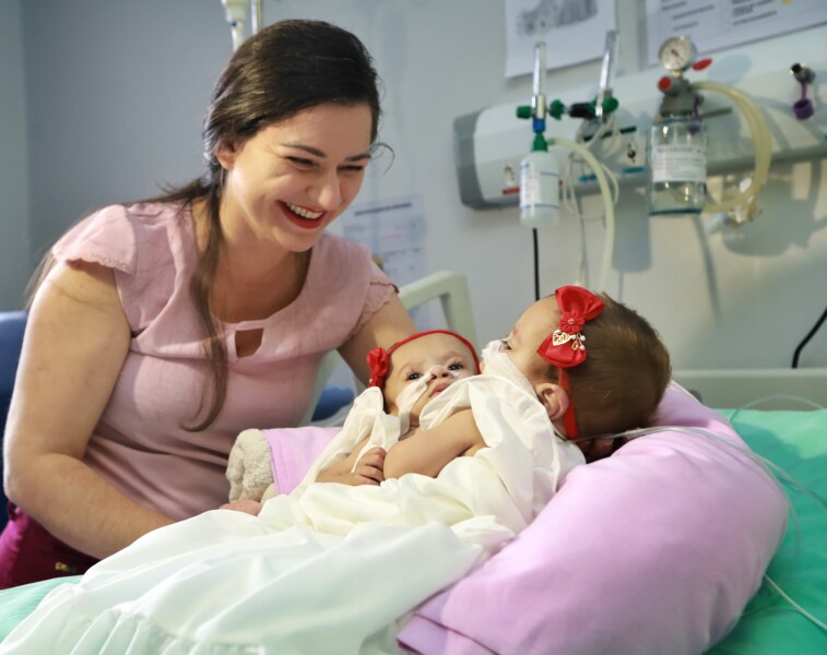 siamesas-lara-e-larissa-recebem-alta-apos-nove-meses-de-internacao